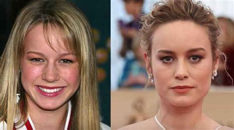 did brie larson have a boob job|Brie Larson Plastic Surgery